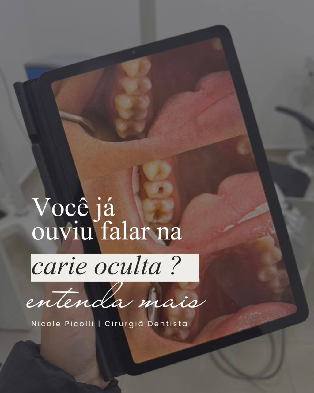 Post adaptado por aluna do nicho Inventário